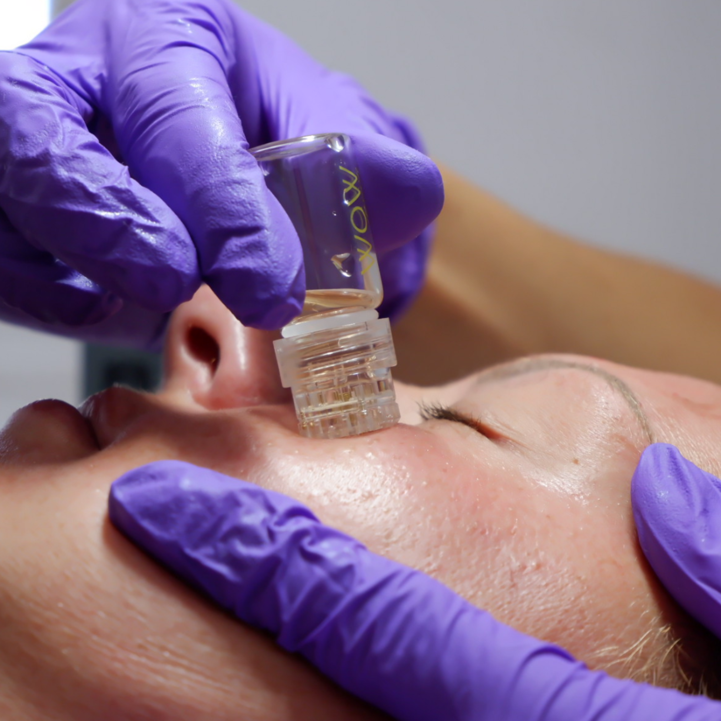 aesthetics micro need